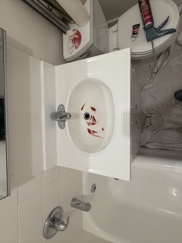 Before sink refinishing - stained and damaged bathroom sink